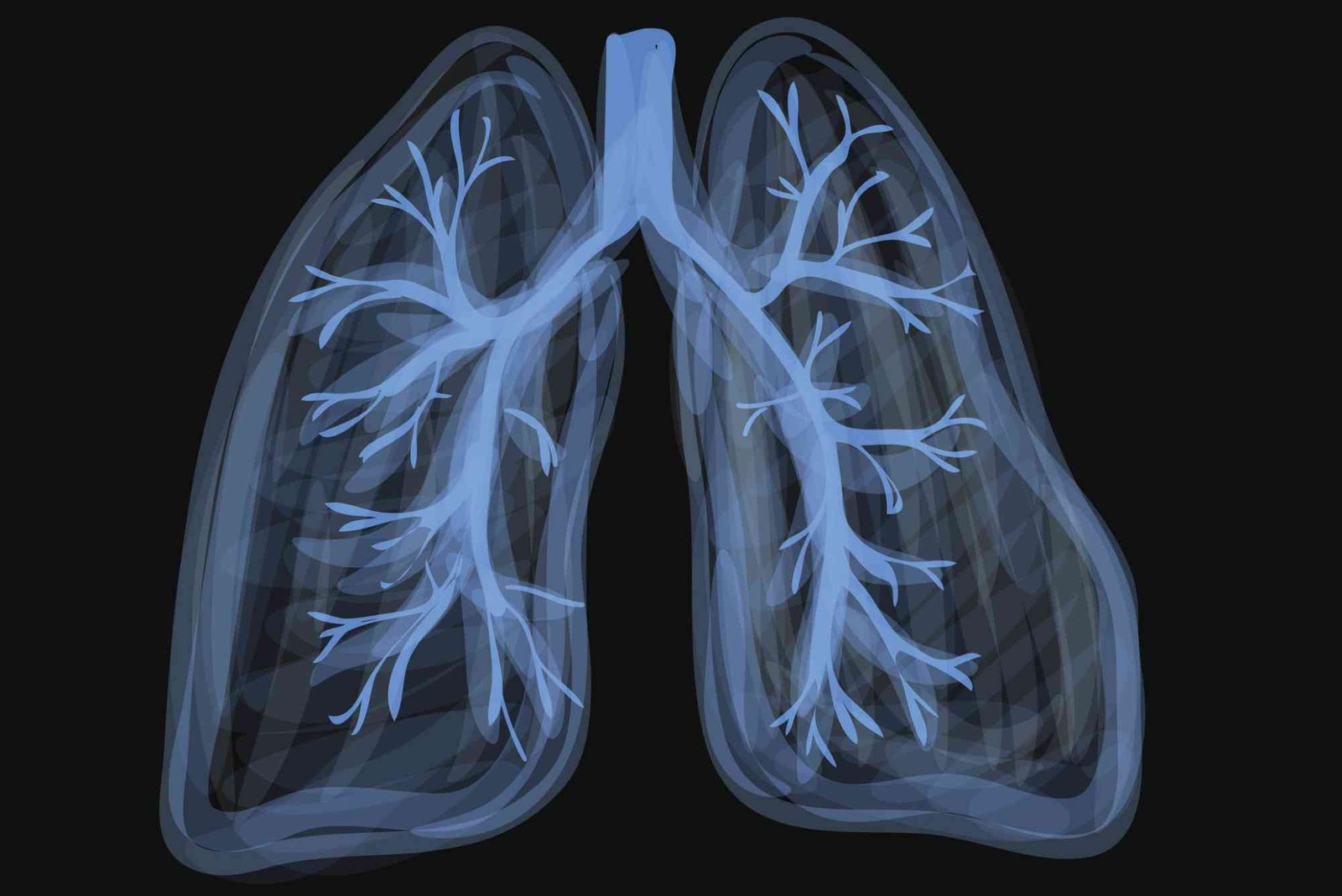 Vape Lung Injury UAE