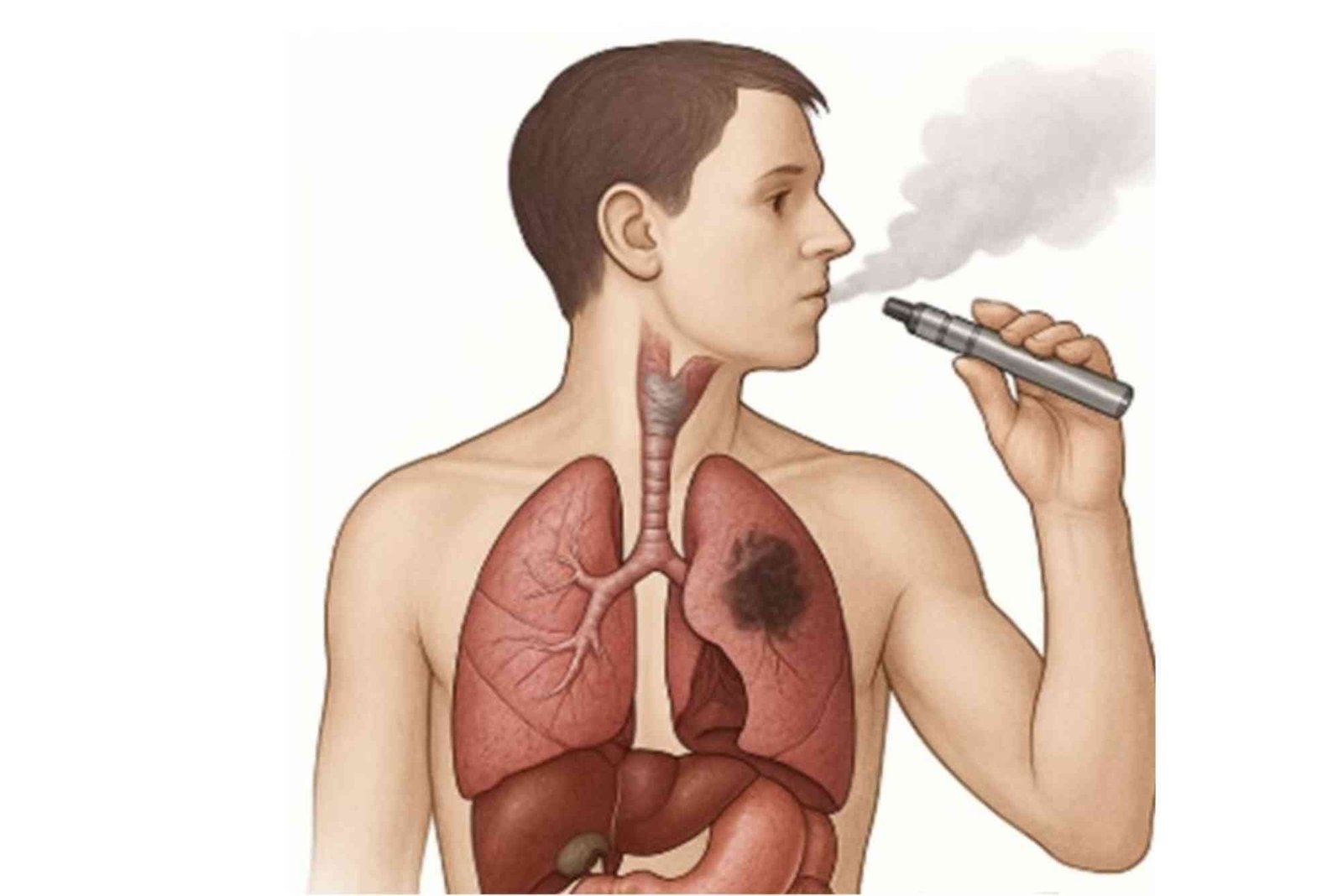 Health Issues Caused By Vaping